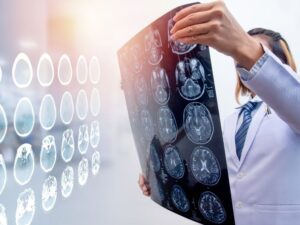 Types of Traumatic Brain Injuries