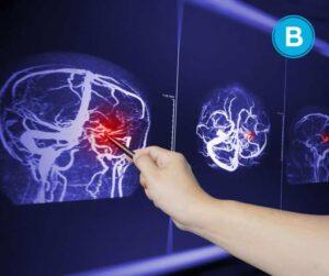 March is Traumatic Brain Injury (TBI) Awareness Month, and Brooks Law Group is here to take part.